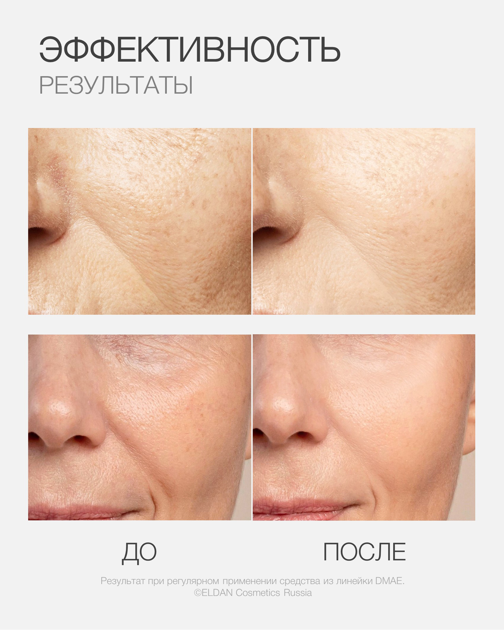 Пост ДМАЭ 25 5 (до после).jpg